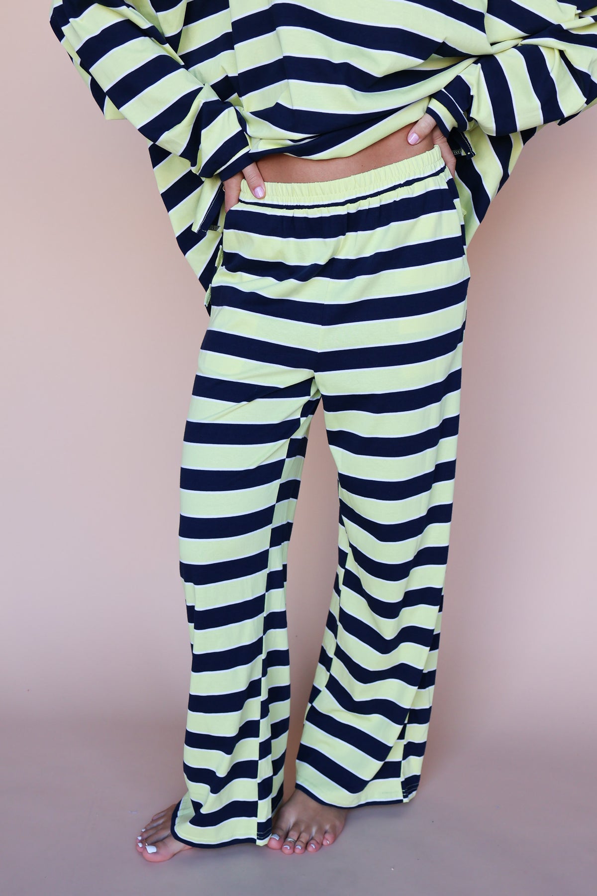 Lemon Fizz Stripe Pants